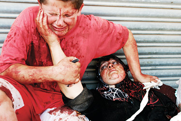 An injured boy seeks comfort from his mother after an Israeli plane bombed their van in Tyre, Lebanon, last week